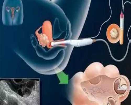 51宝贝试管代孕_三代试管费用明细_Q3514_8snV9_24岁备孕期间可以吃乌鸡白凤丸补气