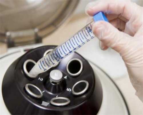 南昌代孕的手术费_51j78_d4bI8_孕早期白带增多无出血,偶尔肚子胀是正常的吗?