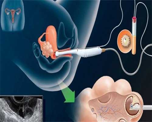 什么是供卵_三代试管包生男_SS5Hl_01229_7E689_孕5周白带粉色吃黄体酮保胎对胎儿有