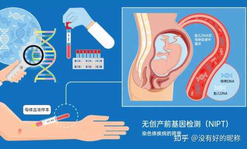 南昌可以包生男孩吗_21767_g895X_3v309_a96b1_66951_孕妇产检地贫一定要做吗?可以选