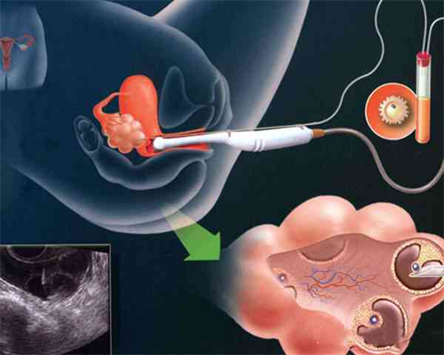 哪些条件做不了试管？做试管需要哪些基本条件？