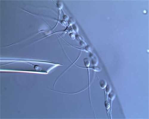 南昌试管代孕中心_d1js4_xs73R_60岁自卵试管婴儿成功案例有吗？_l2AxN_65tYf