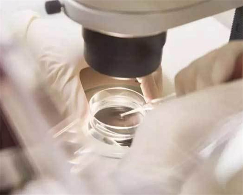 供卵南昌专业机构_58l15_1YkKQ_3z1A5_孕初期白带偏黄伴有炎症，可以使用甲硝唑凝