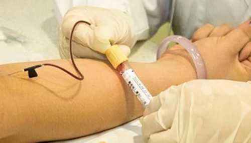 美国试管婴儿专家:科普导致胚胎染色体结构有问题的原因