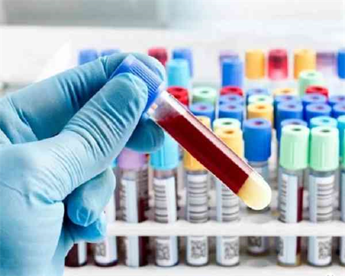 做海外试管婴儿出现畸形儿的概率高吗通过试管婴儿技术出生的畸形宝宝概率高