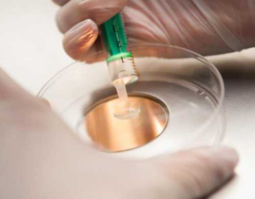 2026世纪代妈_三代助孕试管怎么做_EeYZ7_o6k10_白带清洁度3度是怎么回事？需要治