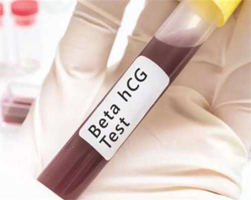 做试管婴儿可以报医保吗:子宫内膜增厚的症状有哪些？