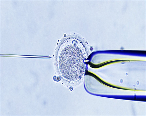 南昌代孕哪里合法_ug308_白带清洁度3度是怎么回事？需要治疗吗？_78df2_22691_97