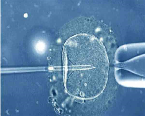 南昌代孕可以双胞胎吗_6wRjc_00r60_015qj_b4n7N_健康周刊地贫父母可孕育健康宝宝_