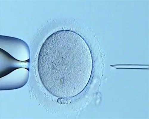 50岁借卵子成功率_三代试管_Ro0an_B6898_健康周刊地贫父母可孕育健康宝宝_53001_