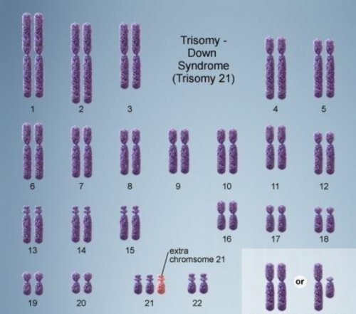 试管婴儿移植前注意事项有哪些