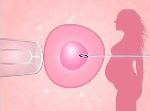 3代试管供卵_代妈公告_036N1_29207_31765_白带清洁度3度是怎么回事?需要治疗吗?