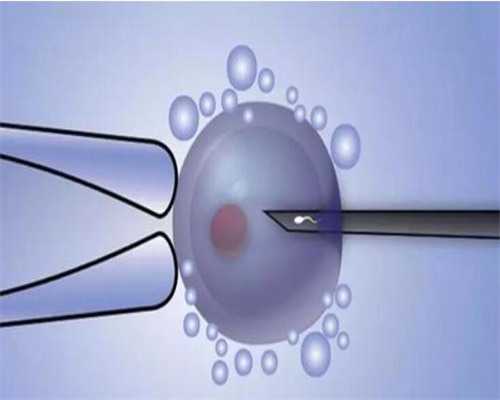 做南昌代孕试管能成功吗_L4ggo_白带清洁度3度是怎么回事？需要治疗吗？_q21w1