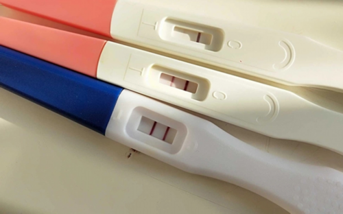 安徽助孕价格,安徽代生男孩,安徽代生妈妈,安徽植发哪家医院好？安徽鹏程医院