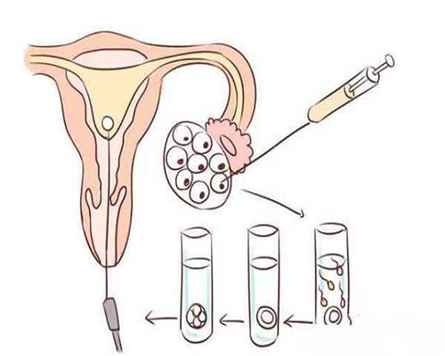 代生宝宝价钱_哪里代生比较好|石家庄人工助孕成功率是多少