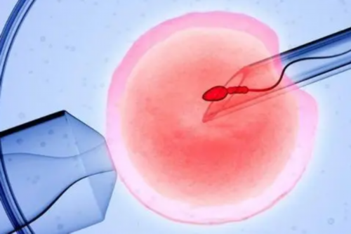 三代试管多少钱_aa69助孕|葫芦岛多囊卵巢综合症做试管婴儿的几率多大,