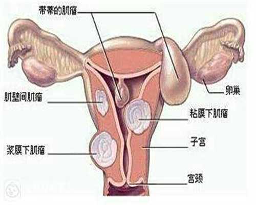 三代试管的具体步骤_专业代妈_天津ab血型捐卵 天津哪些医院可以做供卵试管