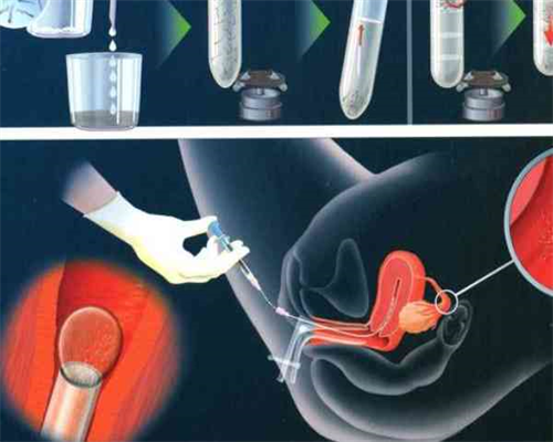 65万包成功_代怀专业吗|【广州哪里做供卵试管婴儿好】男医生，技术好，检查