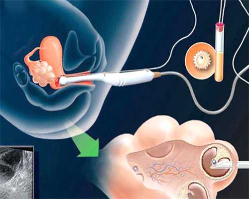 代怀孩子微信_代怀三甲医院_泸州试管哪个医院好(泸州做试管哪家医院好)