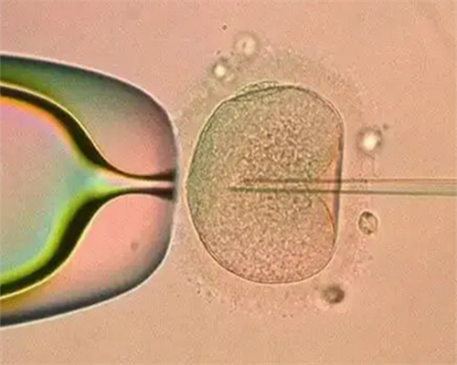 厦门妇幼保健院供精人工授精整个流程费用多少钱？