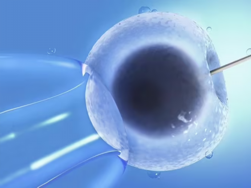 代怀医院费用_有偿代怀网_就在昨天，包头首例试管婴儿诞生