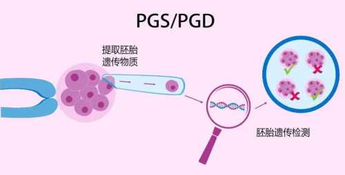 胚胎移植后上厕所会掉出来吗？北京试管婴儿医院哪家好？