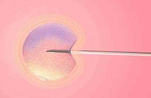 rfg皇家医院_代妈工资_4HYt2_73Z52_K080A_果纳芬在冬天零下3度可以不放冰箱冷藏吗？