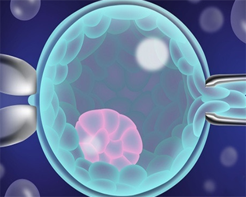 试管婴儿或者代孕的孕妈妈为什么会去做亲子鉴定？