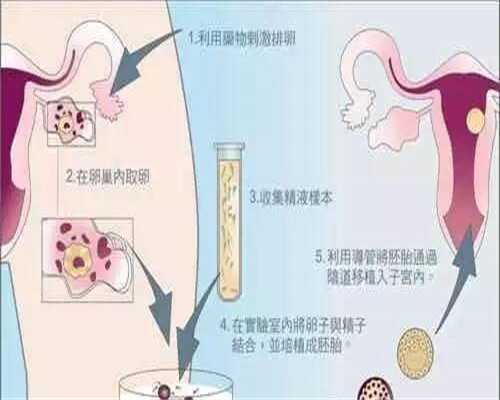 吃了优思悦屈螺酮炔雌醇片卵泡大小还长吗？