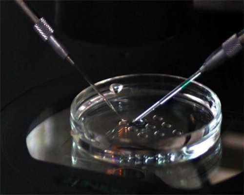 代怀孕的权威机构_代怀孕急救小游戏_南充做试管婴儿的费用明细表,南充试管婴