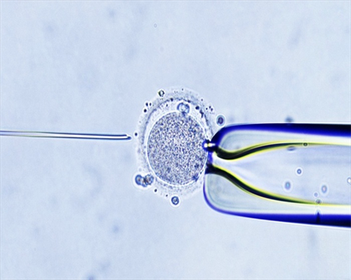 AA69代孕合法吗_365国际代孕|保山试管婴儿费用大概要多少钱第三代？保山哪家医