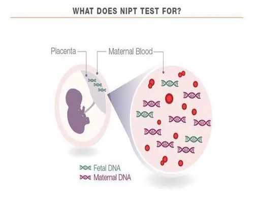供卵代怀价格_代怀妈妈_延安多囊卵巢综合征能做试管吗?多囊卵巢综合征要先