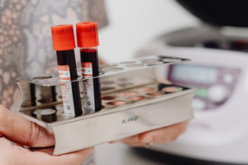 南昌无卵巢借卵试管代孕_HAMe2_01867_t2qF6_白带清洁度3度是怎么回事?需要治疗吗