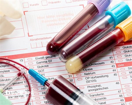 试管婴儿或者代孕的孕妈妈为什么会去做亲子鉴定？