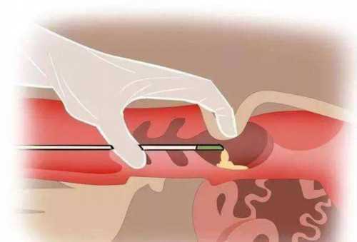 专业代怀网_AA69地址|大连妇幼保健院生殖科怎么样(株洲中心医院做试管找哪个