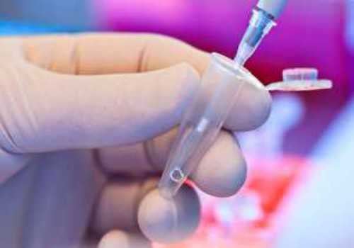 合肥买卵子要多少钱 合肥105医院试管首例?试管后都应该注意哪些事项? ‘四