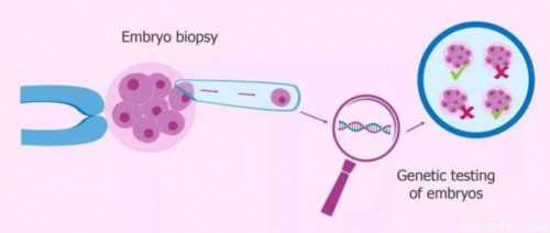 三代试管选男孩_二代试管供卵婴儿_太原正规捐卵招聘 太原供卵试管费用明细：