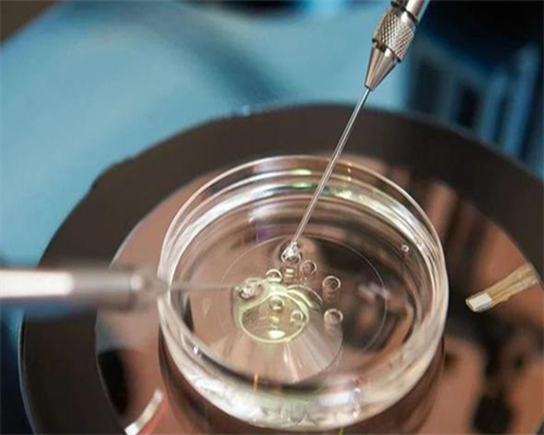 合肥代孕的费用多少钱 合肥市试管婴儿费用的影响因素 ‘40ⅹ24mm孕囊是男还是