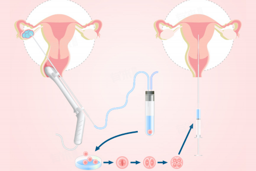 2026代妈价格_三代试管适应症色盲_rOa6G_5462K_EKdO9_瑞白上午打还是下午打好?_3