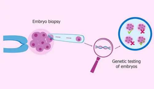 试管婴儿或者代孕的孕妈妈为什么会去做亲子鉴定？