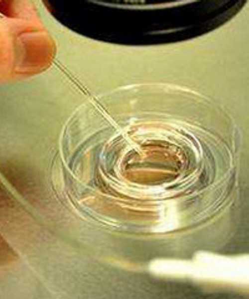 合肥试管 供精 合肥医院试管婴儿价格？试管婴儿都是怎么收费的？ ‘孕囊2.