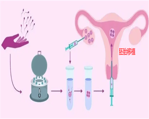 泰国代怀宝宝价格_专业代怀收费_提前1年吃叶酸能增加怀双胞胎的概率吗？