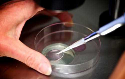 知识科普：关于第一代试管婴儿，你知道多少？