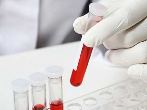 试管婴儿或者代孕的孕妈妈为什么会去做亲子鉴定？