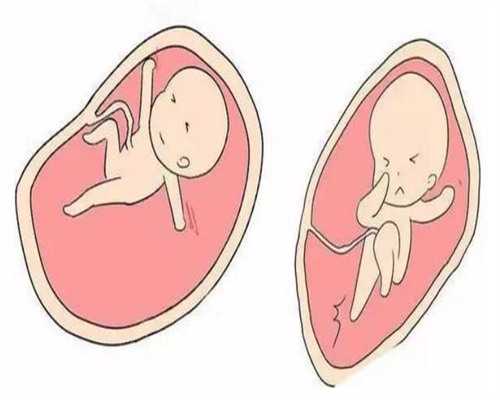 南昌代孕价格表查询_74303_白带清洁度3度是怎么回事？需要治疗吗？_H022P_S1M33