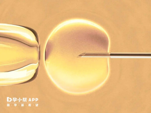 2026自然代妈_三代试管包性别_苏州供卵试管合法化 苏州市立医院试管婴儿医生