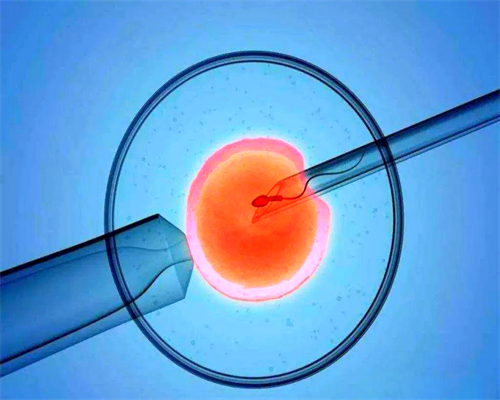 南昌供精助孕是什么意思 2026南昌康健生殖医院试管生男孩费用一览 ‘b超如何