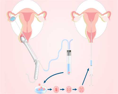 合肥国内代孕公司|合肥供卵试管婴儿多少钱（中介价格33133元）