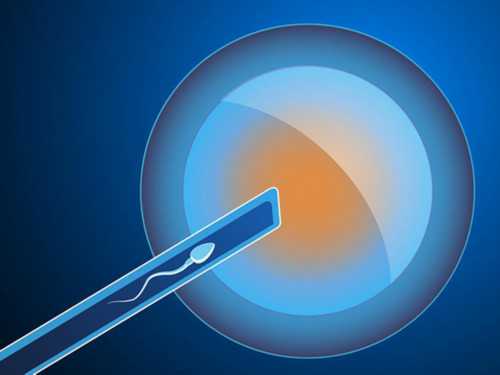 代怀中心哪家好_代怀孕尚德_宁波妇幼儿童医院做二代试管要多少钱？一次试管