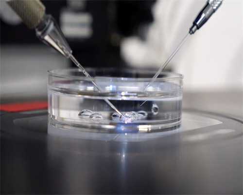 合肥捐卵真的吗 合肥宝宝微信app办理上户 ‘医大二三维单子能看出男女吗’